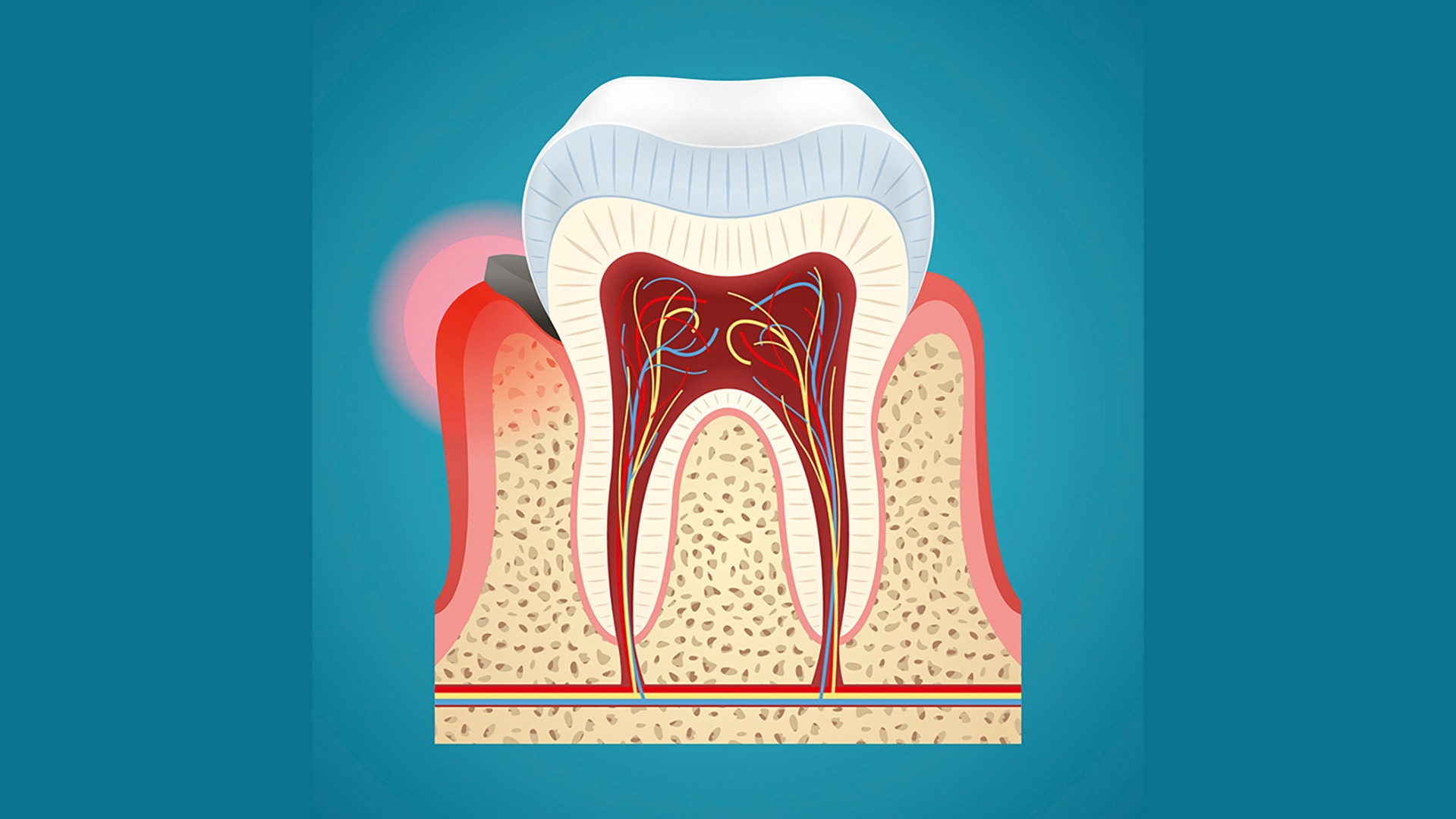 Patient Und Zahnfleischgesundheit - DENTAL Team Online